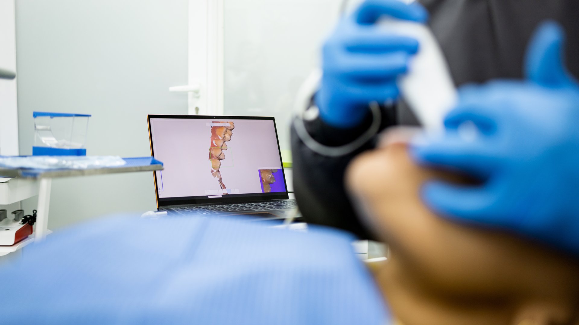 A dentist in blue gloves uses an intraoral scanner on a patient, with a laptop displaying the digital scan in the background.